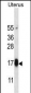GPHB5 Antibody (C-term)